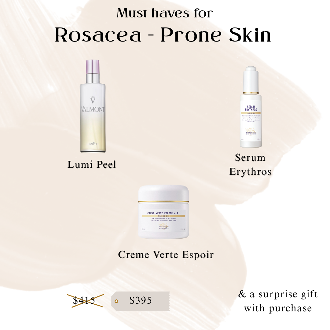 Must-Haves for Rosacea-Prone Skin Bundle