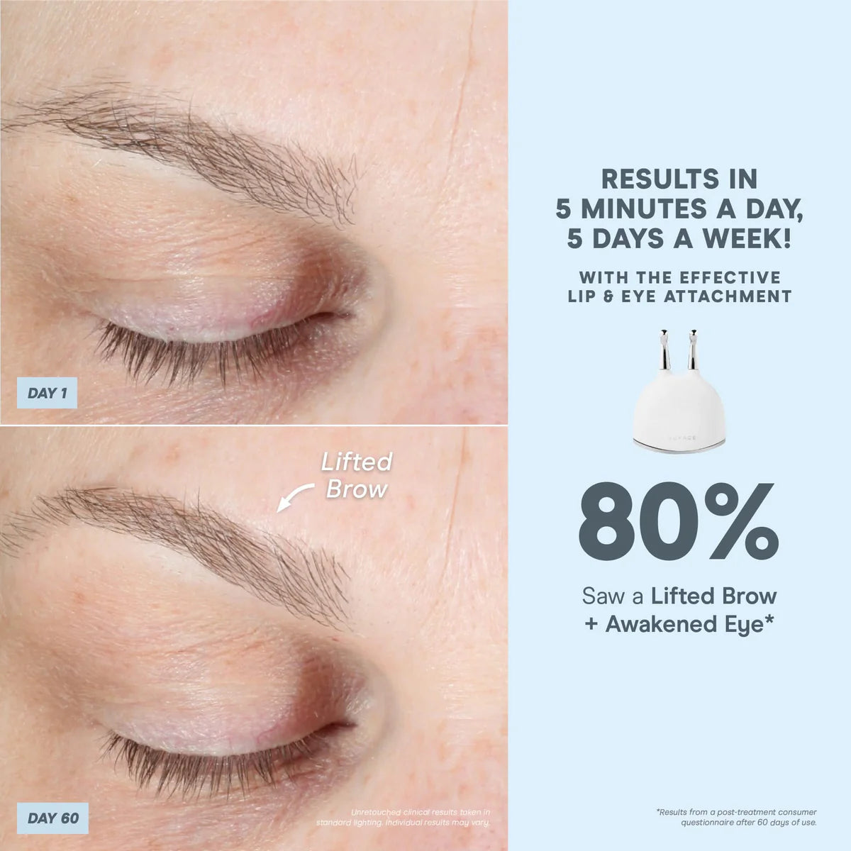 TRINITY+ with Effective Lip & Eye Attachment