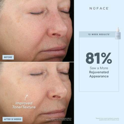 NuFACE® Super Antioxidant Booster Serum - Atelier Beaute Corp