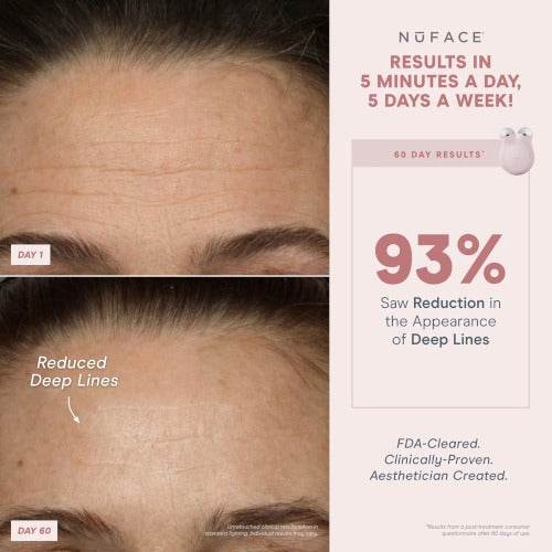 NuFACE Mini+ Petite Facial Toning Device - Atelier Beaute Corp