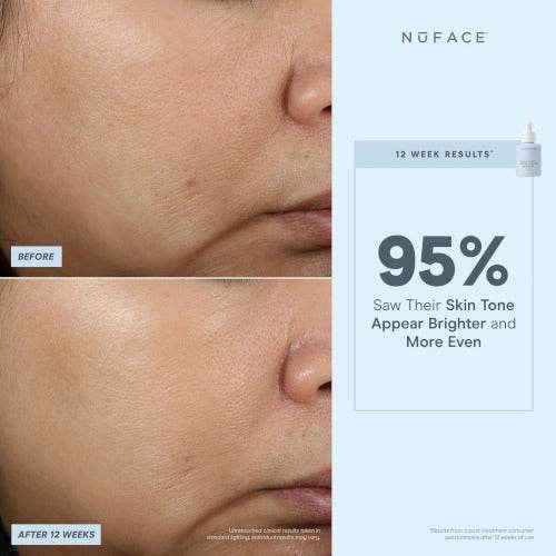 NuFACE® Super Vita-C Booster Serum - Atelier Beaute Corp