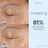 NuFACE® Super Vita-C Booster Serum - Atelier Beaute Corp