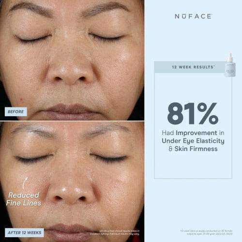NuFACE® Super Vita-C Booster Serum - Atelier Beaute Corp
