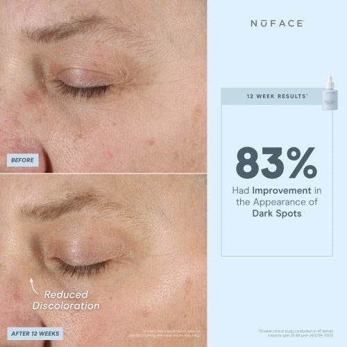 NuFACE® Super Vita-C Booster Serum - Atelier Beaute Corp