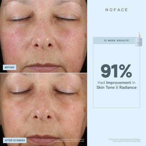 NuFACE® Super Vita-C Booster Serum - Atelier Beaute Corp