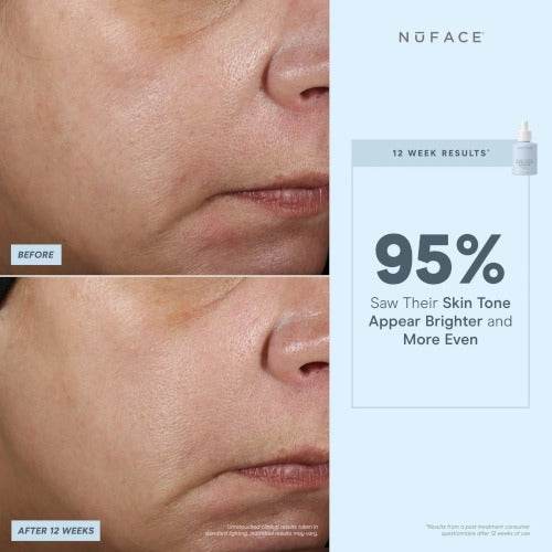 NuFACE® Super Vita-C Booster Serum - Atelier Beaute Corp