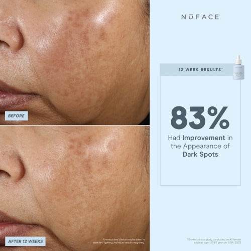 NuFACE® Super Vita-C Booster Serum - Atelier Beaute Corp