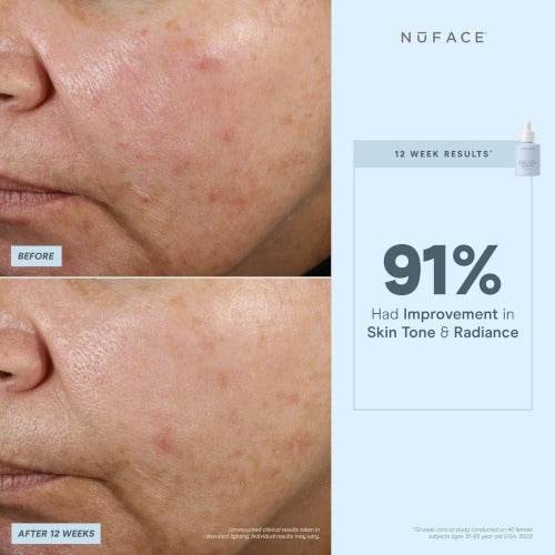 NuFACE® Super Vita-C Booster Serum - Atelier Beaute Corp